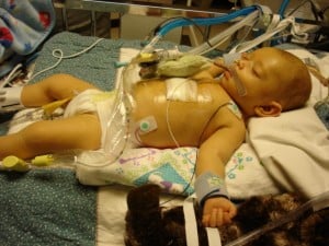 Small baby in a hospital bed who is post heart surgery and hooked up to medical monitors.