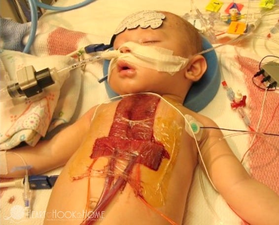 A Letter to Jimmy Kimmel and His Son