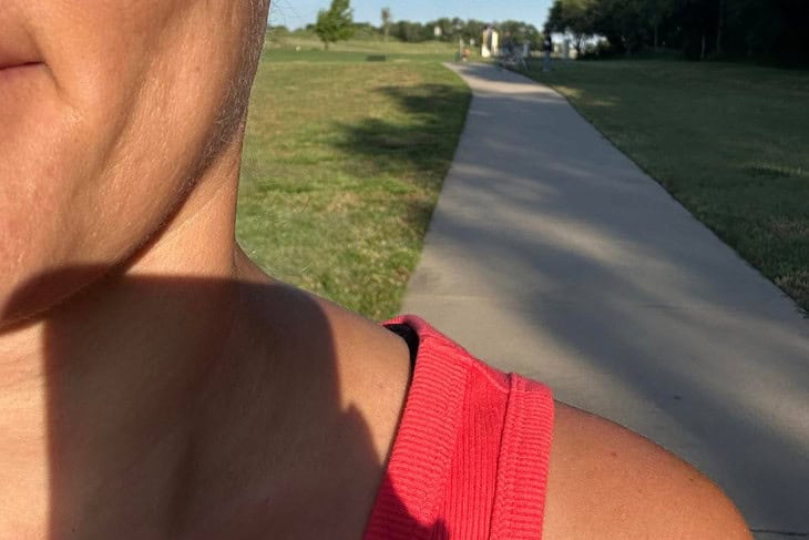 Partial face of a female and a park setting behind her.