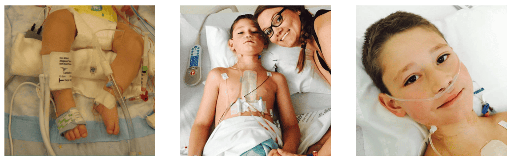 Caden after multiple cardiac procedures