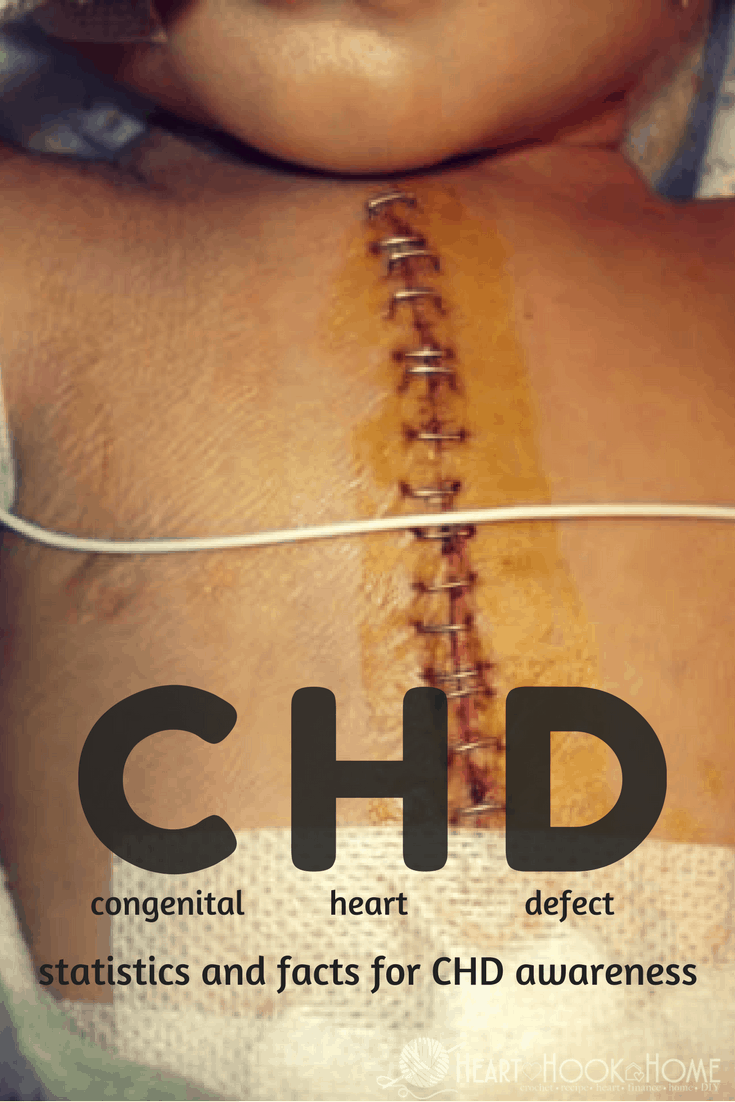What is a Congenital Heart Defect? Statistics You Need To Know From a CHD Mom