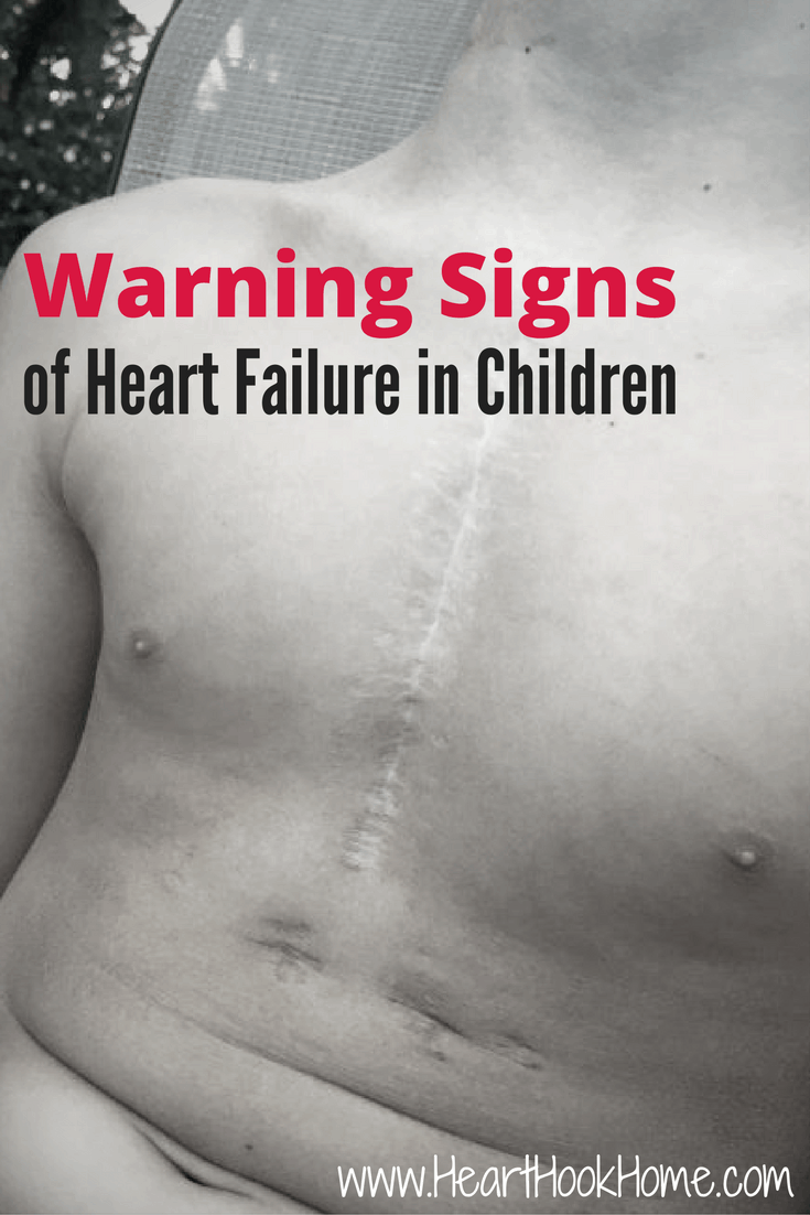 Warning Signs of Heart Failure in Children